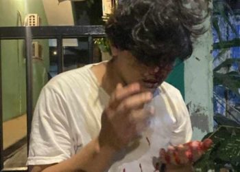 Seorang Pria Dikeroyok Sekelompok Orang Tidak Dikenal di Grogol