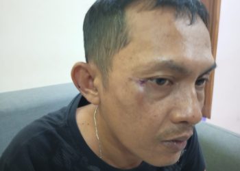 Wartawan yang Sedang Liputan Dianiaya Orang Tak Dikenal