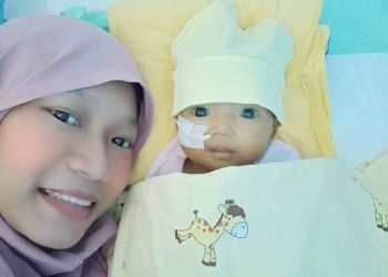 Balita 1 Tahun Menderita Atresia Bilier, Butuh Uluran Tangan